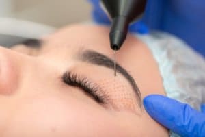 women receiving blepharoplasty